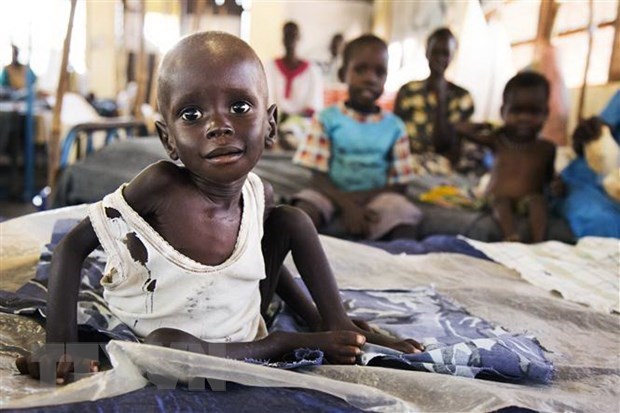 A malnourished child in South Sudan (Photo: AFP/VNA)