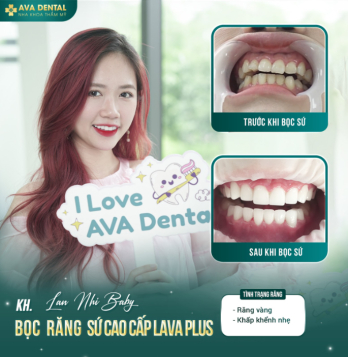 AVA Dental - Nha khoa chuyên sâu thẩm mỹ răng sứ cho Việt Kiều