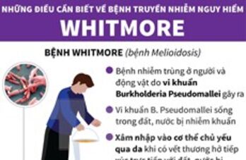 Những điều cần biết về căn bệnh nguy hiểm Whitmore