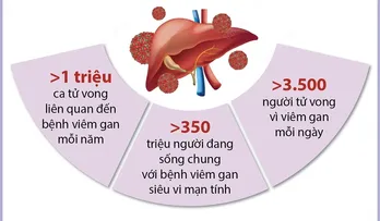 Ngày Thế giới phòng chống viêm gan: Thận trọng với bệnh viêm gan virus