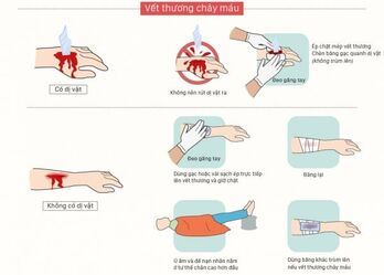 Phòng, chống tai nạn do máy móc, thiết bị